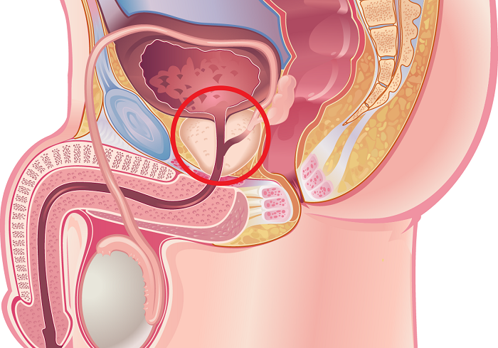 Recenzii ale petelor urologice pentru prostatită